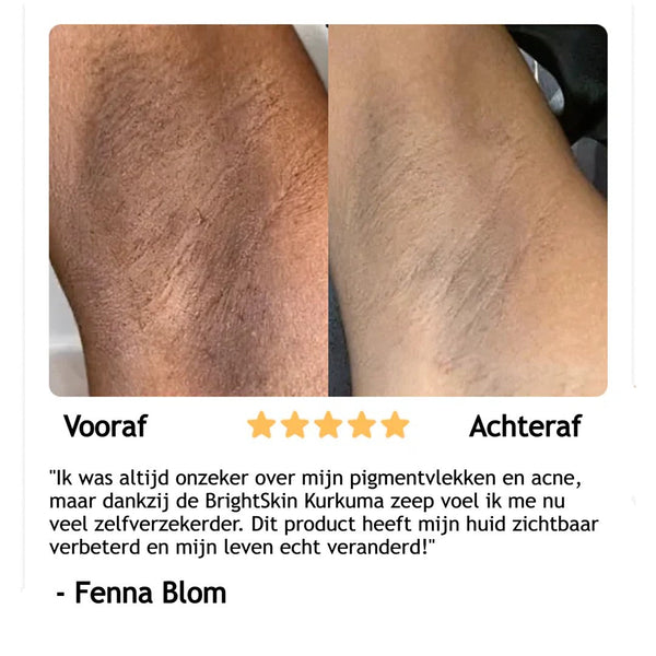 BrightSkin™ Kurkuma Seifenwunder