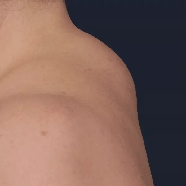 SanSpine NekPijn Therapie