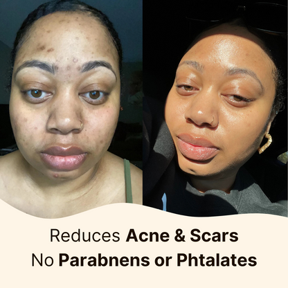 Stralende Huid Met Beef Tallow