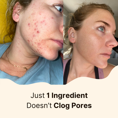 Stralende Huid Met Beef Tallow